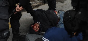 REPRESIÓN – Régimen | Dura represión del macrismo contra manifestantes. Heridos y policías de civil como en la dictadura.