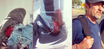 REPRESIÓN EN EL SUR  – Régimen | En la represión a obreros de una maderera disparan por la espalda contra Diputado del PTS.