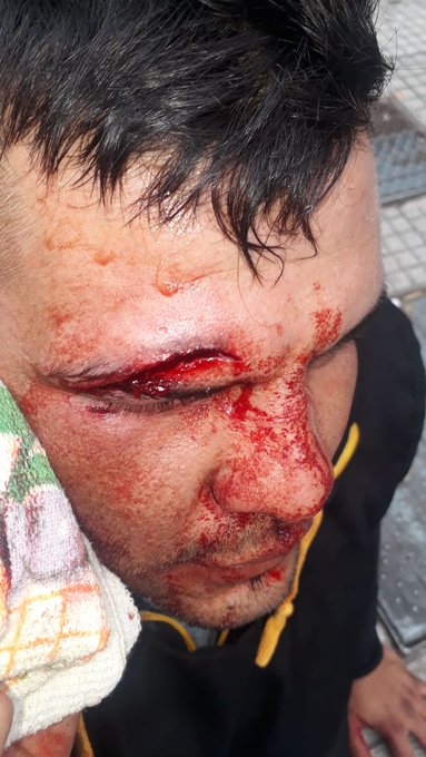Manifestante herido por la represión policial en la 9 de Julio en la CABA.