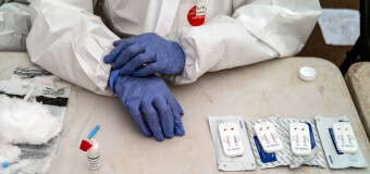 CORONAVIRUS – Mundo | La ONU advierte que se está en el peor momento de la pandemia.